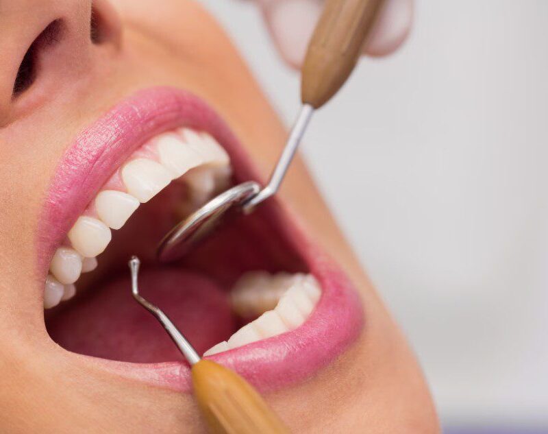 sem-caries-analise sem-caries-analise